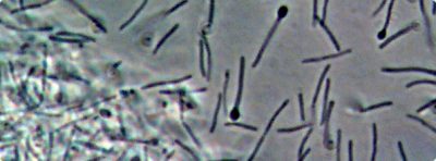 "Turd Timber" By Qteros Makes Biofuel from Human and Animal Excrement