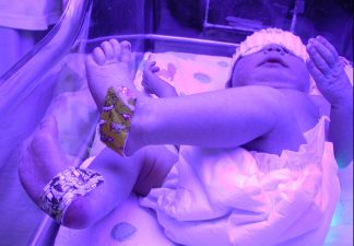 Mozart helps preemies gain weight