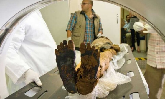 mummie egypt clogged artery