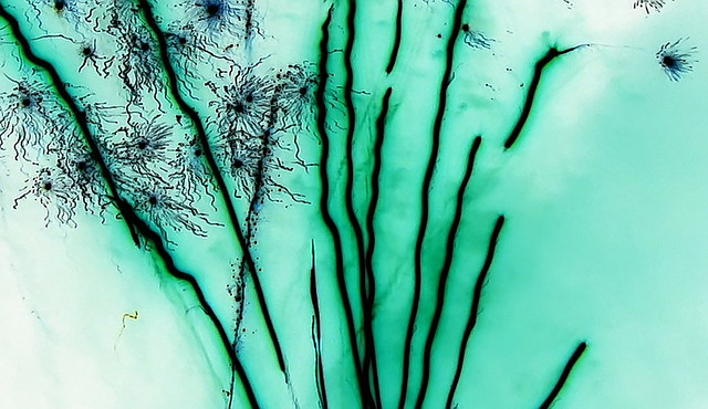 Fenugreek seeds linked to E. coli Outbreak