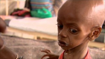 hungry somali child