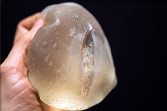 PIP Breast Implant Warnings Hit Middle East