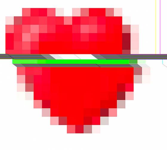 Study Links Fluoride to Cardiovascular Disease