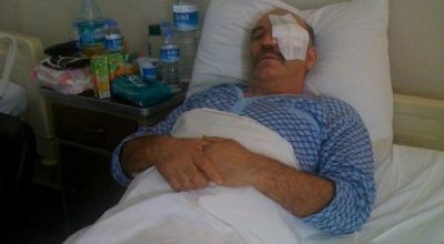 Environmentalist Partially Blinded By Illegal Fishermen In Istanbul