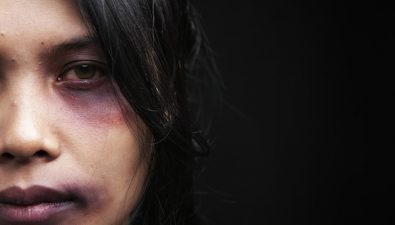 Lebanon’s Finally Looking at Racism and Human Rights Abuses in the Face