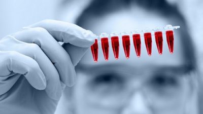 Get Your Blood Tested for Heavy Metals