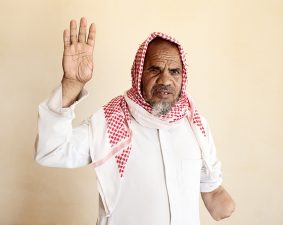 Egyptian Bedouins Maimed by Land Mines in Achingly Beautiful Portraits