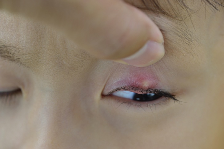 Drug-Resistant Bacteria Might Destroy Us Before Global Warming