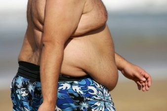 Globally, Obesity is Now Deadlier Than Hunger