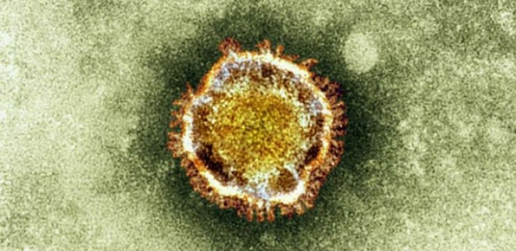 MERS-virus-e1398613163601.jpg