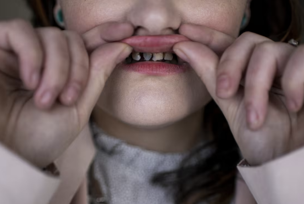 NBC covers report on forever chemicals linking them to teeth