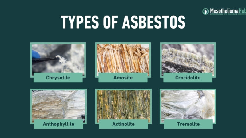 Asbestos and Cancer and Why Mesothelioma Is So Hard to Find Early — and Treat