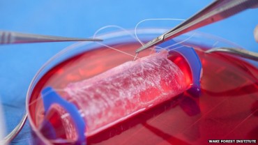 3-D technology gives birth to lab-grown vaginas