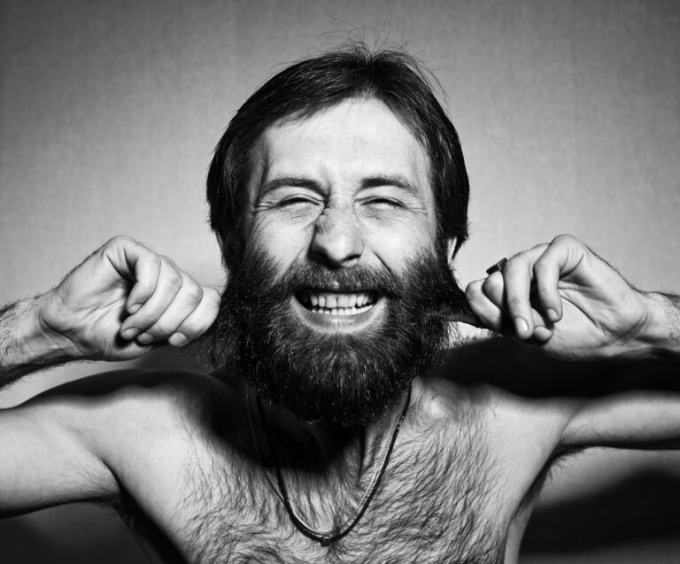 Beard transplants are a “growing” Middle East trend