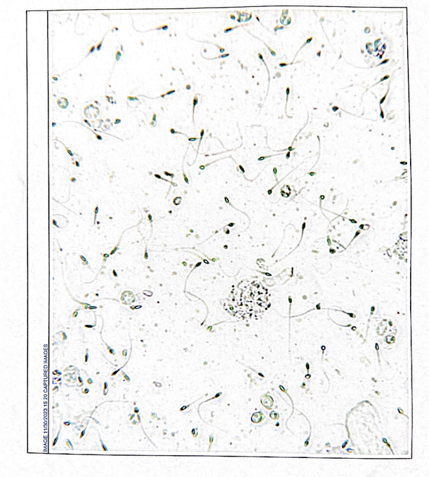 Bryan Johnson's sperm. He;'s not afraid to put his personal data out there.