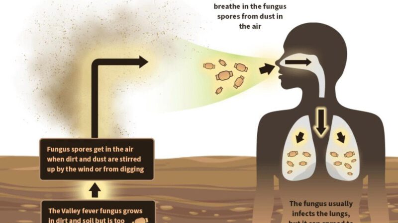 California droughts boosts the Valley Fever fungus