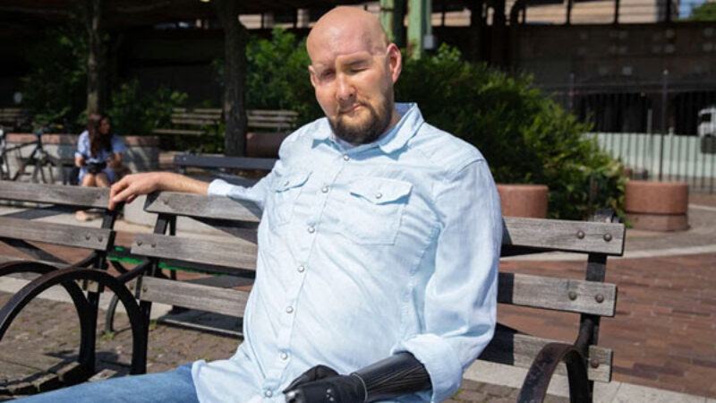 First whole eye with transplant successful