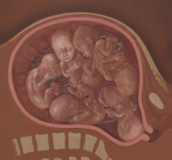 Sex selection kits for embryos available in the US and Canada