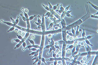 Play your cannabis plants some white noise?