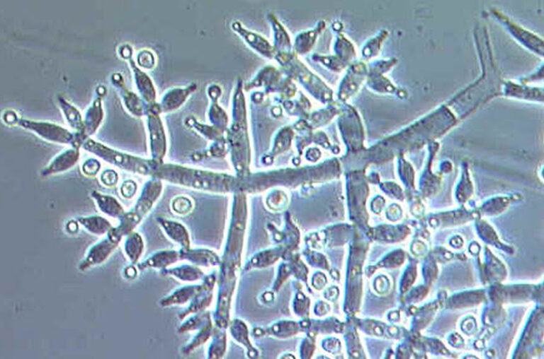 Play your cannabis plants some white noise?