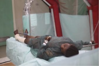 There is negative pressure on Ebola with Sys isolation tents from Israel