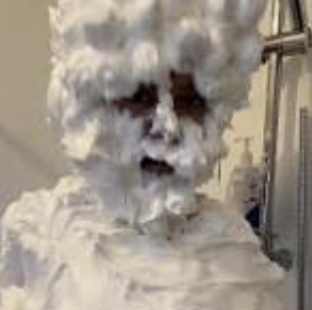 Are you tired of shaving cream, sticky sugar wax concoctions? Maybe it's time for a laser.