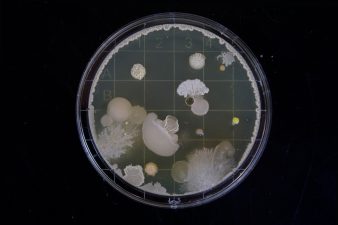 New lab test for antibiotic resistance better times treatment