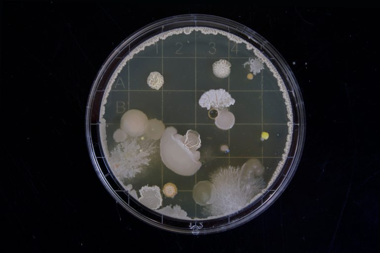 New lab test for antibiotic resistance better times treatment