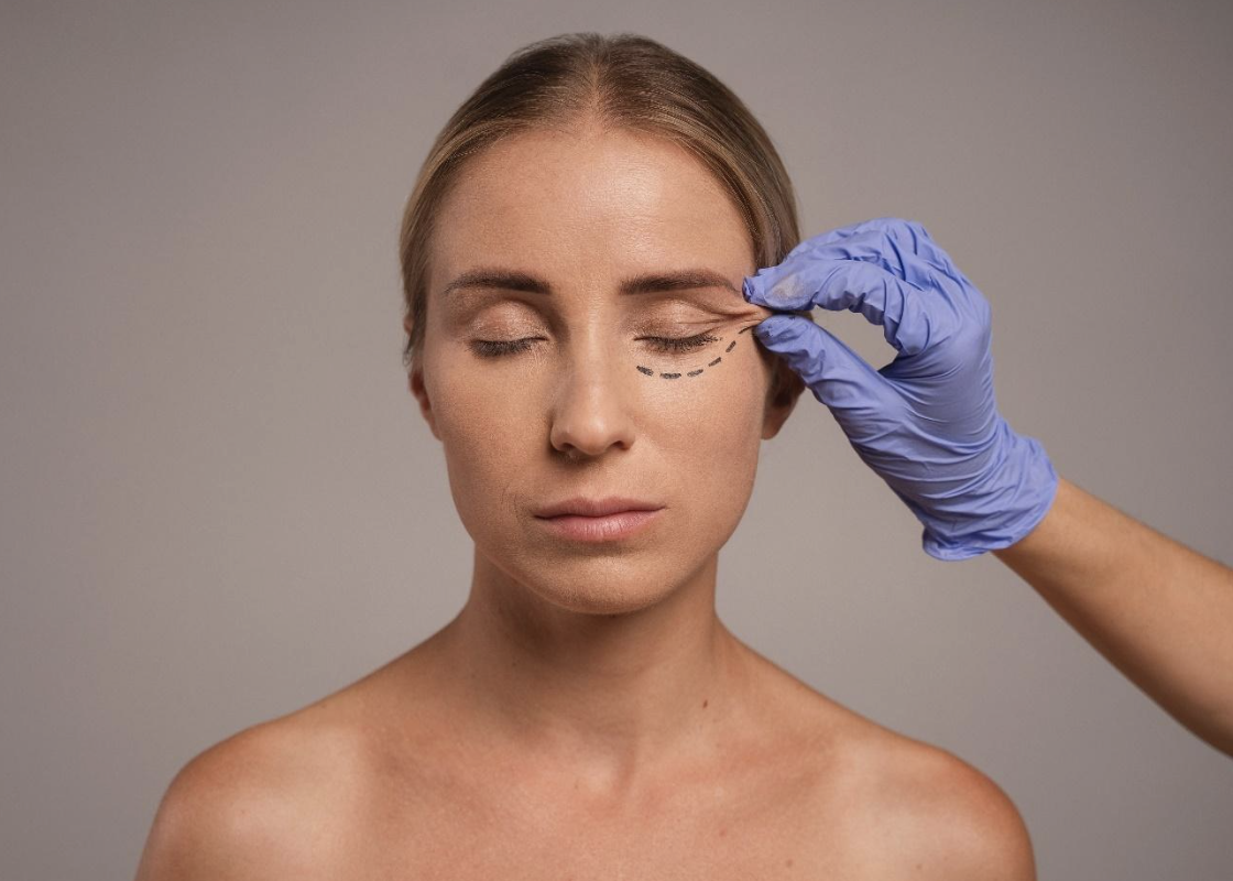 People today want natural, expressive, long-lasting results without the stiffness or long recovery once associated with facelifts. Below is a clear, gentle comparison of both methods to help illustrate how each one fits into modern aesthetic surgery.