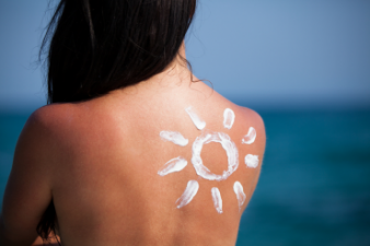 Sunscreen isn’t enough against skin cancer – new research
