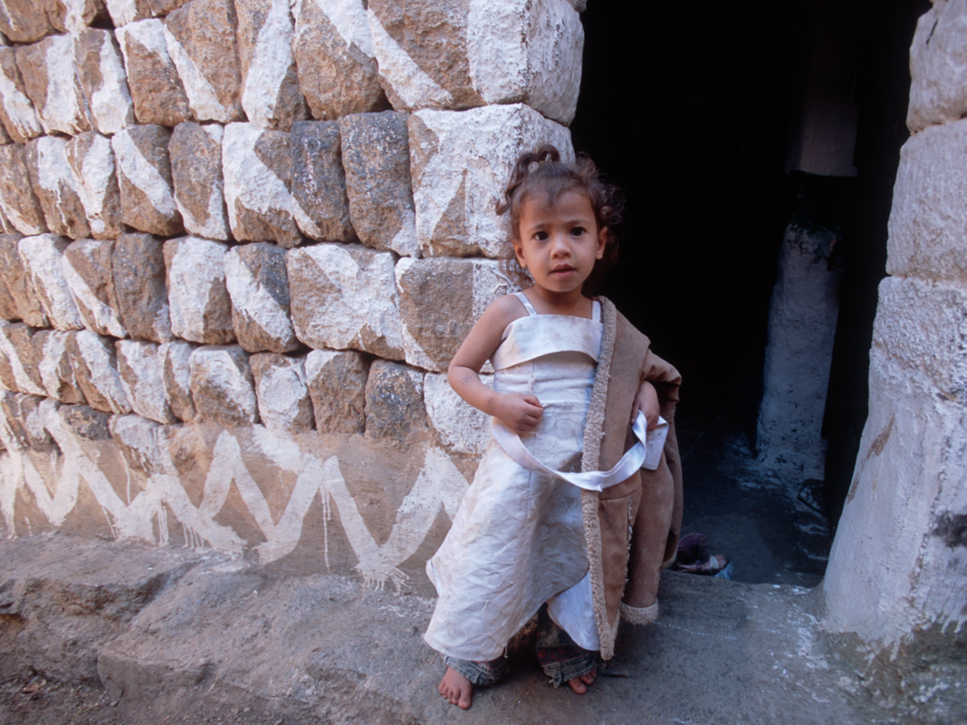 Yemen is starving, Ukraine war is making it worse